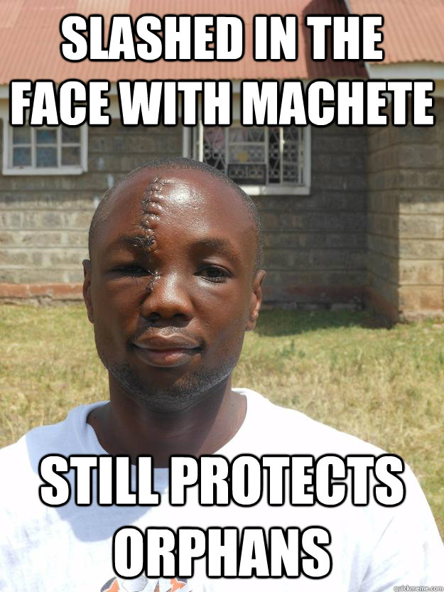 Slashed In the Face with machete still protects orphans  