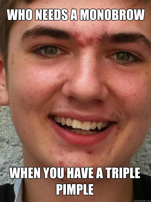 WHO NEEDS A MONOBROW WHEN YOU HAVE A TRIPLE PIMPLE  