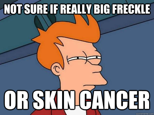 Not sure if really big freckle or skin cancer - Not sure if really big freckle or skin cancer  Not sure if deaf