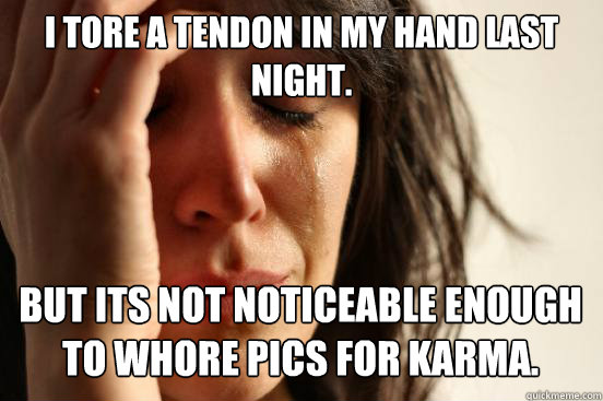 I tore a tendon in my hand last night. But its not noticeable enough to whore pics for karma.   First World Problems