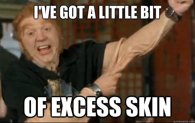 I've got a little bit of excess skin - I've got a little bit of excess skin  Fat Bastard