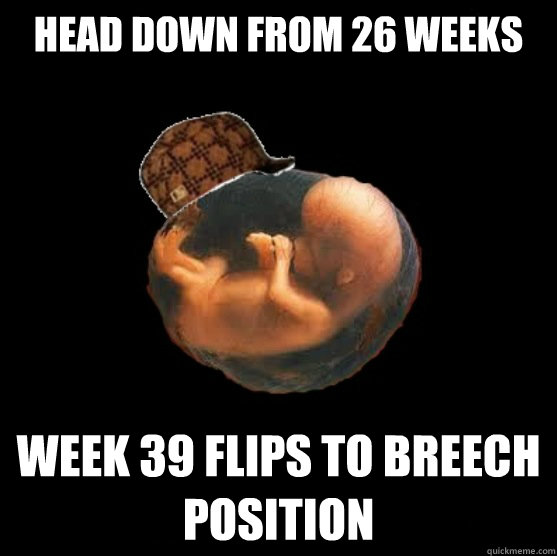 Head down from 26 weeks week 39 flips to breech position - Head down from 26 weeks week 39 flips to breech position  Scumbag Fetus