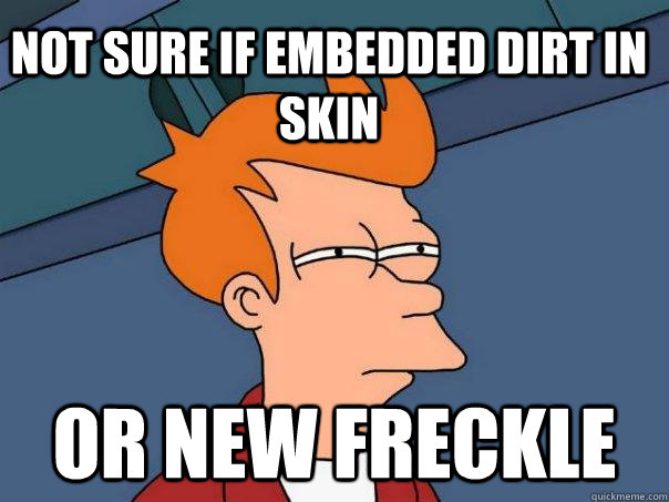 Not sure if embedded dirt in skin or new freckle  Futurama Fry