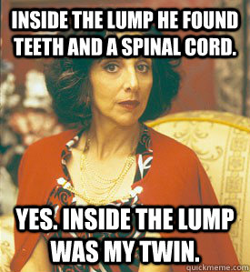 Inside the lump he found teeth and a spinal cord.  Yes. Inside the lump was my twin.   My Big Fat Greek Wedding