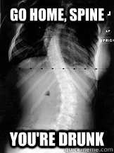 Go home, spine you're drunk  hipster scoliosis