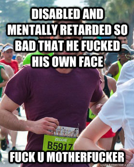 DISABLED AND MENTALLY RETARDED SO BAD THAT HE FUCKED HIS OWN FACE FUCK U MOTHERFUCKER  Ridiculously photogenic guy