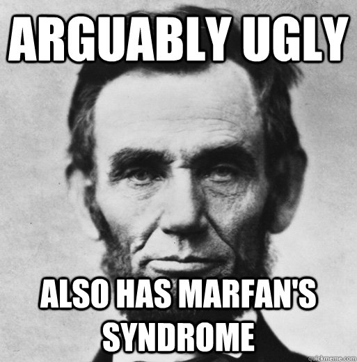 arguably ugly also has marfan's syndrome  