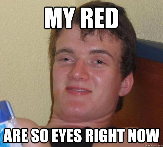 my red are so eyes right now  10 Guy