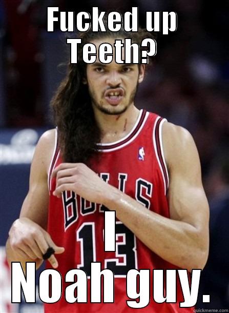 FUCKED UP TEETH? I NOAH GUY. Misc