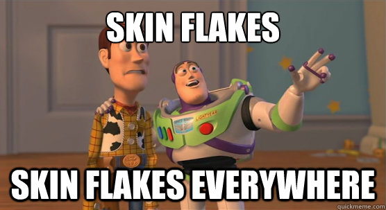 Skin flakes Skin flakes everywhere - Skin flakes Skin flakes everywhere  Toy Story Everywhere