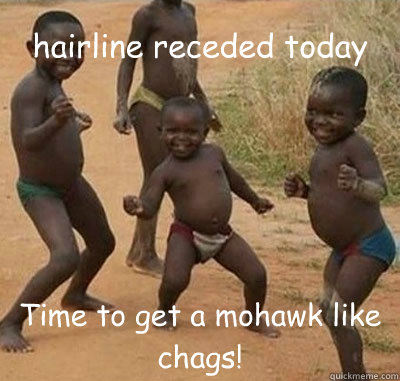 hairline receded today Time to get a mohawk like chags!  