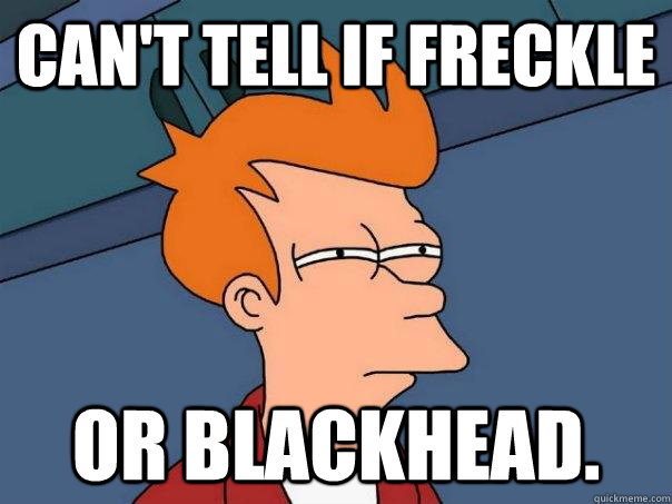 can't tell if freckle or blackhead.  - can't tell if freckle or blackhead.   Futurama Fry