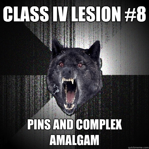class iv lesion #8 pins and complex amalgam  Insanity Wolf