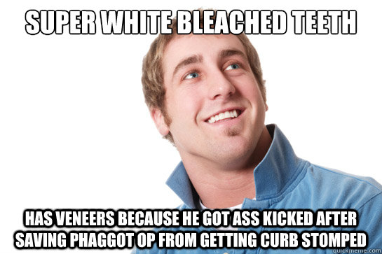 super white bleached teeth has veneers because he got ass kicked after saving phaggot op from getting curb stomped  Misunderstood D-Bag