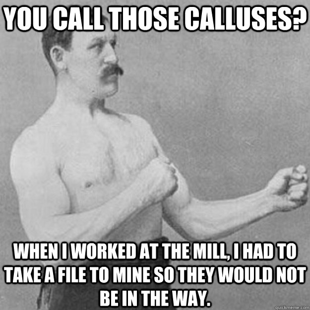 You call those calluses? When i worked at the mill, I had to take a file to mine so they would not be in the way.  overly manly man
