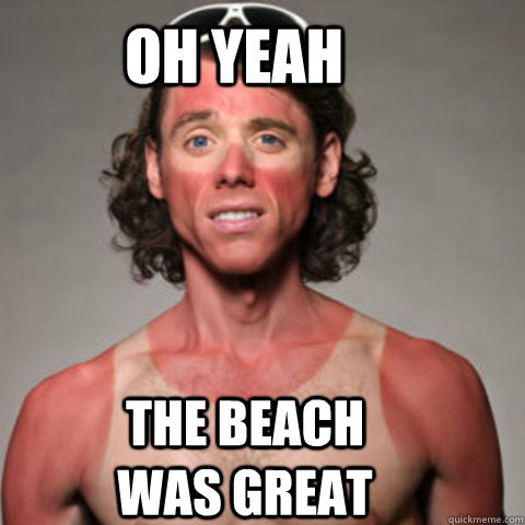 oh yeah the beach was great  Sunburned Dude