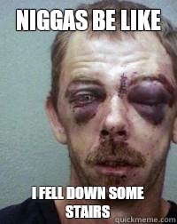 Niggas be like I Fell Down Some Stairs  Niggas be like