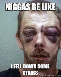 Niggas be like I Fell Down Some Stairs - Niggas be like I Fell Down Some Stairs  Niggas be like