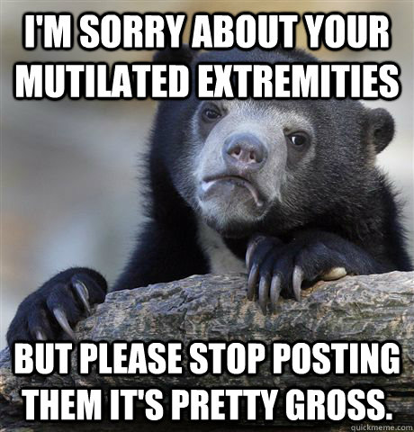 I'm sorry about your mutilated extremities but please stop posting them it's pretty gross.  Confession Bear