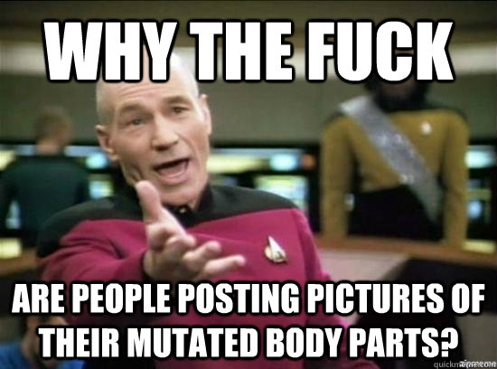 Why the fuck are people posting pictures of their mutated body parts?  Annoyed Picard HD