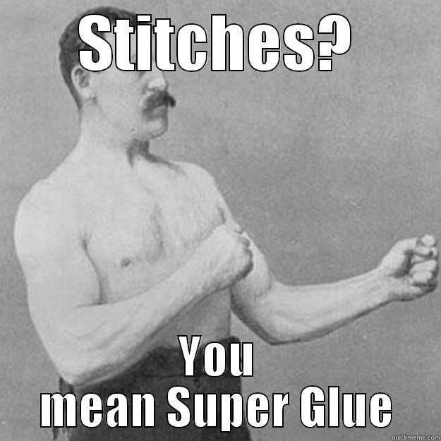 STITCHES? YOU MEAN SUPER GLUE overly manly man