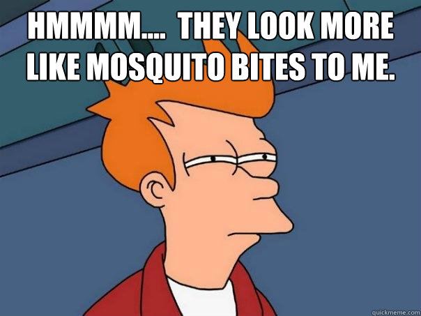 Hmmmm....  they look more like mosquito bites to me.   Futurama Fry