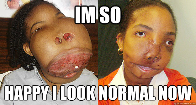 im so  happy i look normal now
 - im so  happy i look normal now
  Misc