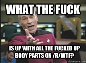 What the fuck is up with all the fucked up body parts on /r/wtf?  Annoyed Picard