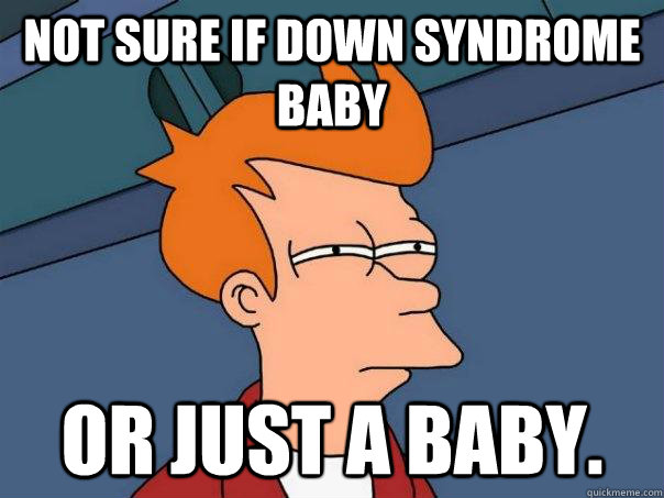 Not sure if down syndrome baby Or just a baby. - Not sure if down syndrome baby Or just a baby.  Futurama Fry