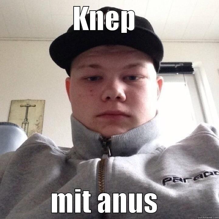 KNEP  MIT ANUS  Misc