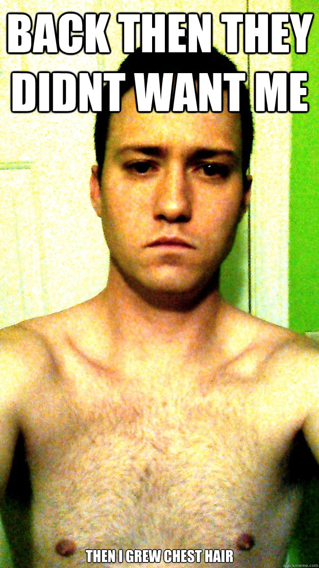 Back then they didnt want me then i grew chest hair - Back then they didnt want me then i grew chest hair  Douchebag Ellis