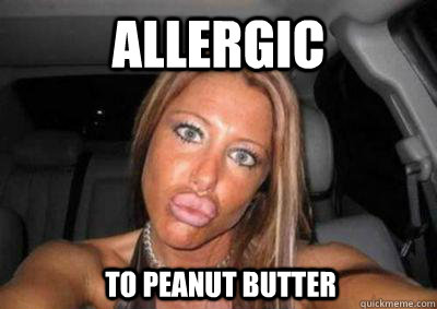 Allergic To Peanut Butter  