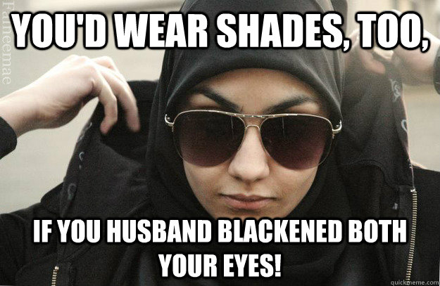You'd wear shades, too, if you husband blackened both your eyes!  