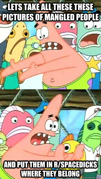 Lets take all these these pictures of mangled people and put them in r/spacedicks where they belong  Push it somewhere else Patrick