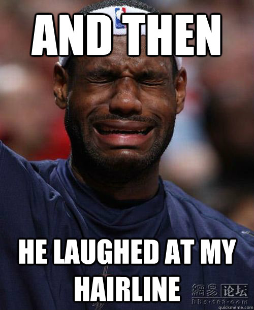 And then  He laughed at my hairline - And then  He laughed at my hairline  Misc