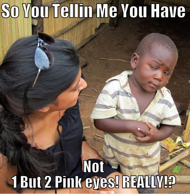 SO YOU TELLIN ME YOU HAVE  NOT 1 BUT 2 PINK EYES! REALLY!? Skeptical Third World Kid