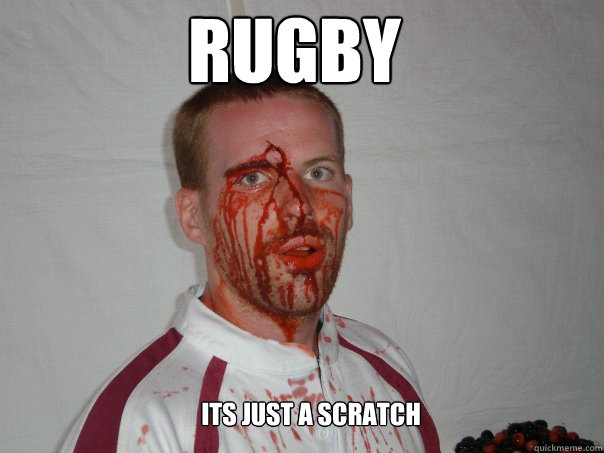 Rugby its just a scratch  