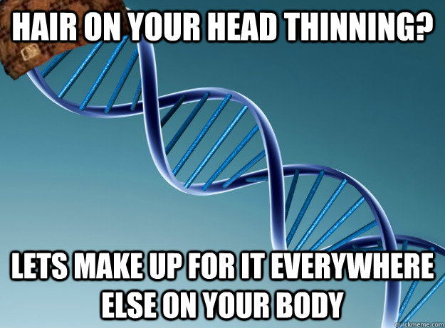 hair on your head thinning? Lets make up for it everywhere else on your body  Scumbag Genetics