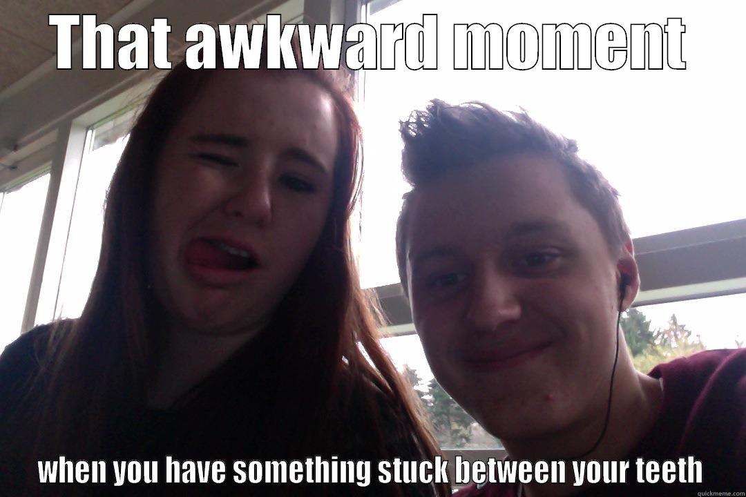THAT AWKWARD MOMENT WHEN YOU HAVE SOMETHING STUCK BETWEEN YOUR TEETH Misc