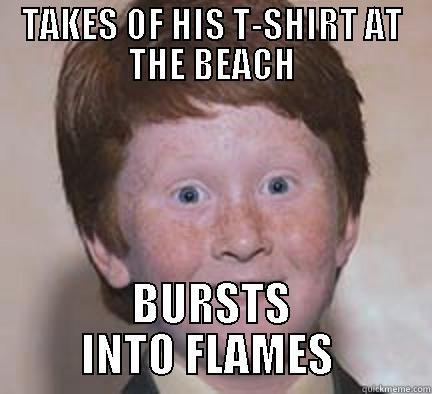 Not a daywalker. - TAKES OF HIS T-SHIRT AT THE BEACH BURSTS INTO FLAMES  Over Confident Ginger