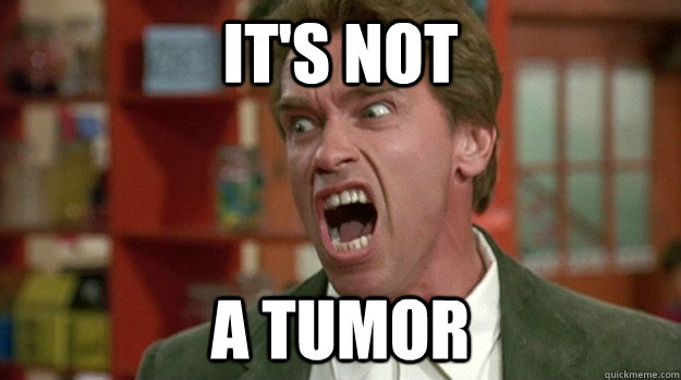 It's not A Tumor  Arnold Schwarzenegger Angrt