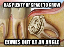 Has plenty of space to grow comes out at an angle  Scumbag Wisdom Tooth