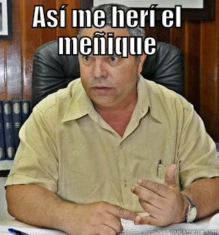 ASÍ ME HERÍ EL MEÑIQUE  Misc