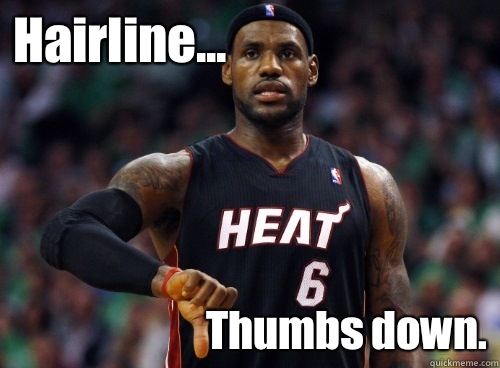 Hairline... Thumbs down.  Lebron James