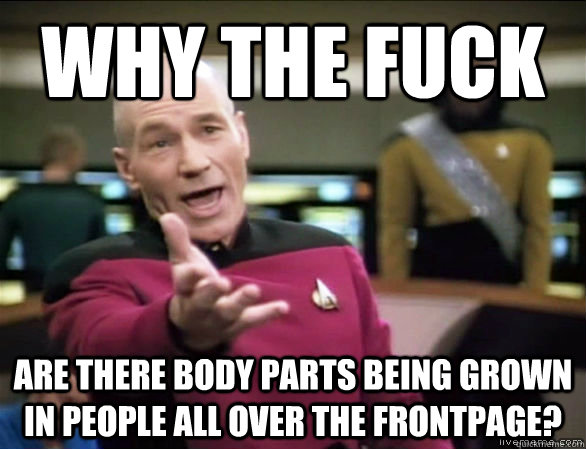why the fuck are there body parts being grown in people all over the frontpage?  Annoyed Picard HD