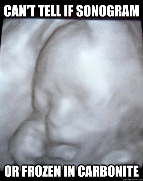 Can't tell if sonogram or frozen in carbonite - Can't tell if sonogram or frozen in carbonite  Carbonite Fetus