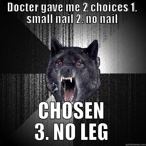DOCTER GAVE ME 2 CHOICES 1. SMALL NAIL 2. NO NAIL CHOSEN 3. NO LEG Insanity Wolf