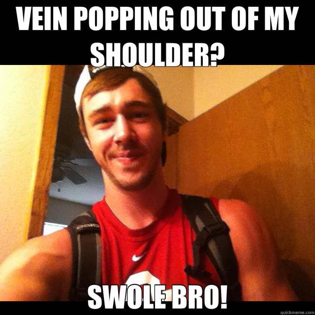 VEIN POPPING OUT OF MY SHOULDER? SWOLE BRO! - VEIN POPPING OUT OF MY SHOULDER? SWOLE BRO!  roid user