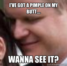 I'VE GOT A PIMPLE ON MY BUTT.... WANNA SEE IT?  