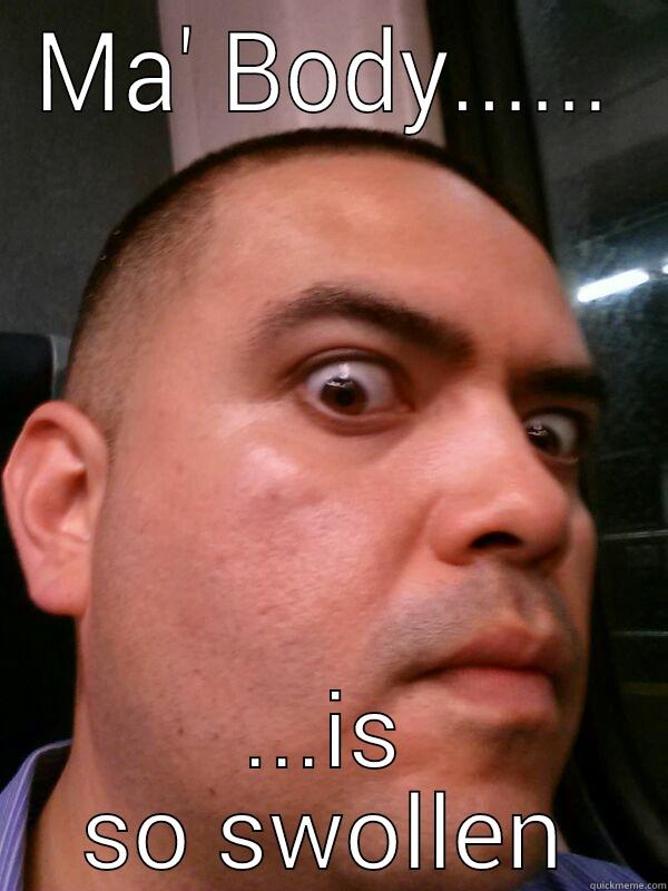 MA' BODY...... ...IS SO SWOLLEN Misc